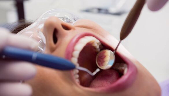 Mouth Ulcers: 9 Powerful Remedies to Heal Fast and Prevent Pain