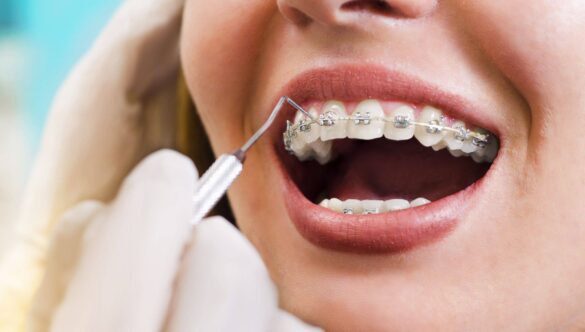 Dental Care Tips for a Brighter Smile in 2025 – Simple Habits for Long-Term Oral Health