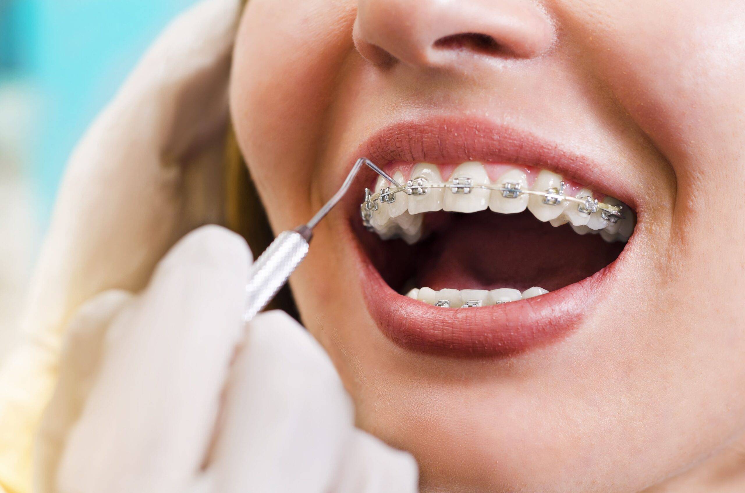Dental Care Tips for a Brighter Smile in 2025 – Simple Habits for Long-Term Oral Health
