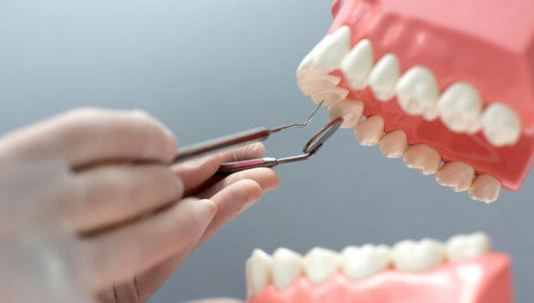 Common Dental Problems in Pune and How to Prevent Them Early