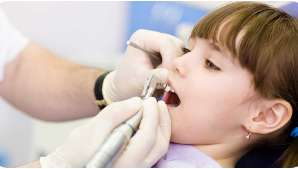 Dental Bridges in Pune – Dr Varsha Merani | Miracle Dental Clinic