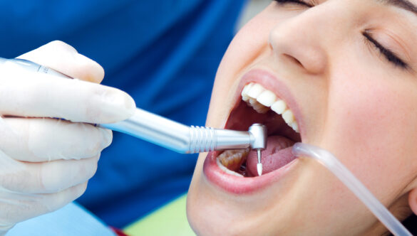 Preventive Dental Care in Pune: Protect Your Teeth Before Problems Start