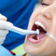 Preventive Dental Care in Pune: Protect Your Teeth Before Problems Start