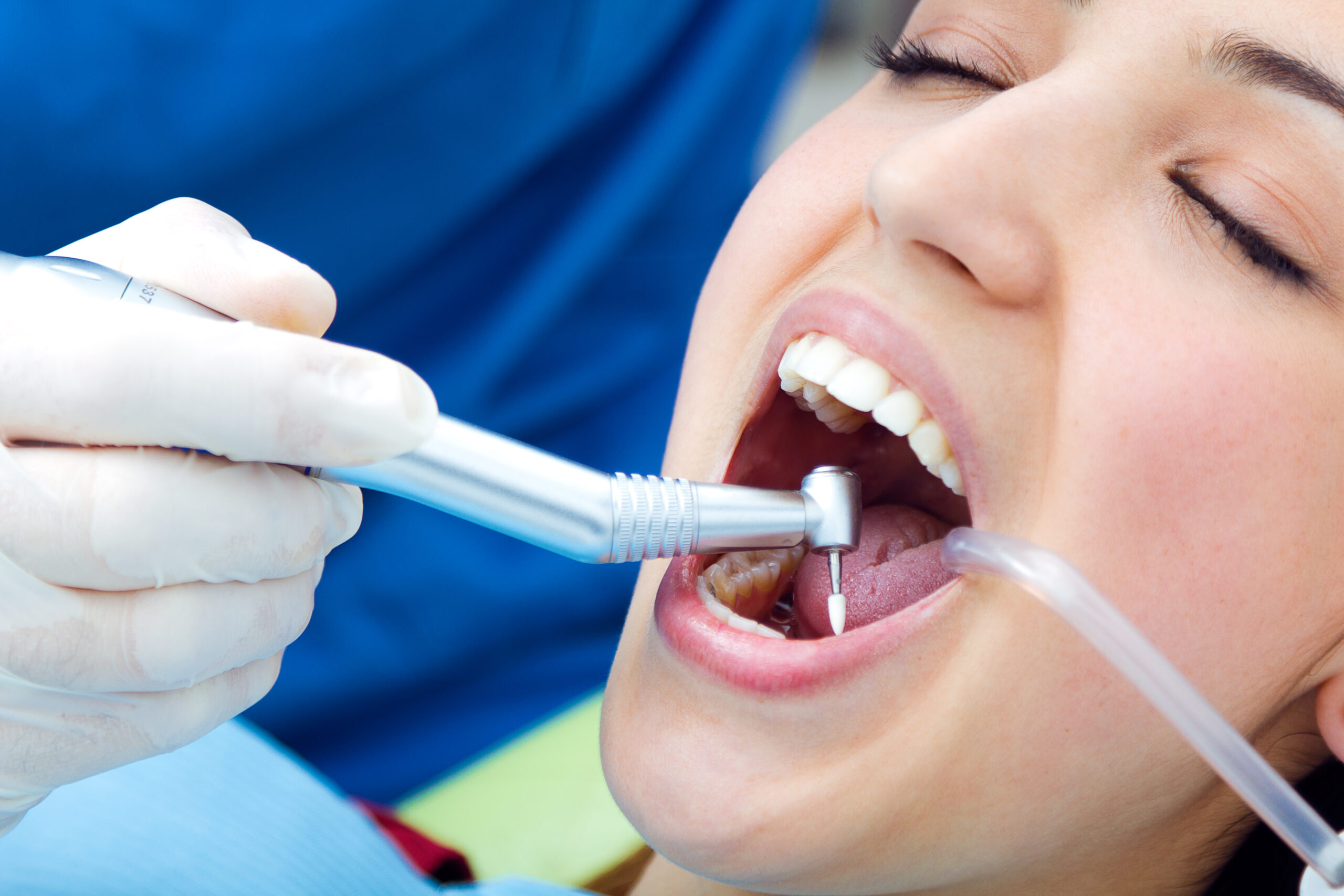 Preventive Dental Care in Pune: Protect Your Teeth Before Problems Start