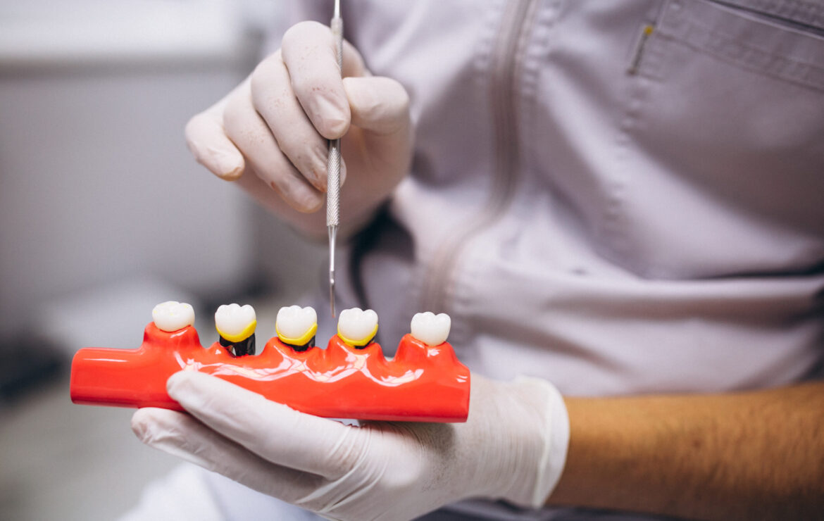 Dental Crowns: Fix Damaged Teeth Fast