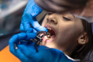 How Preventive Dentistry Can Help Prevent Cavities & Gum Problems