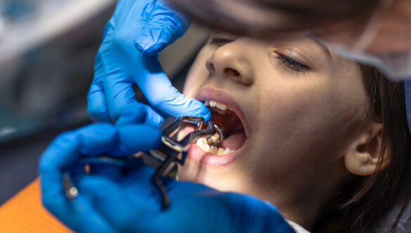 How Preventive Dentistry Can Help Prevent Cavities & Gum Problems
