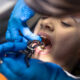 How Preventive Dentistry Can Help Prevent Cavities & Gum Problems